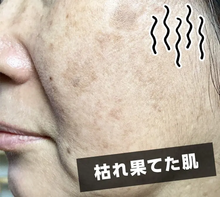 枯れ果てた肌
